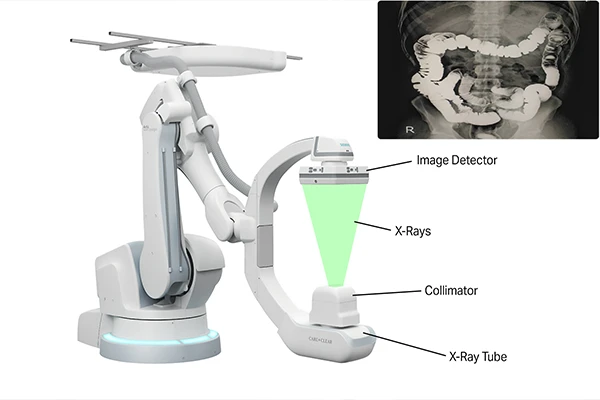 A Guide to Fluoroscopy: Visualizing the Body in Real-Time