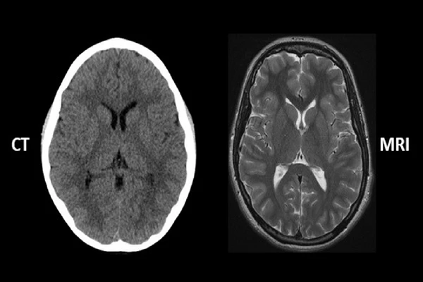 CT vs. MRI: A Detailed Comparison for Technologists