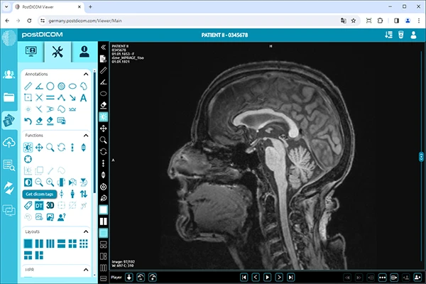 DICOM Tags Explained: A Deep Dive into Medical Image Metadata