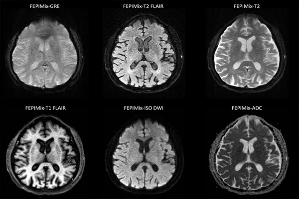 Understanding MRI Sequences: A Guide to T1, T2, FLAIR, and DWI