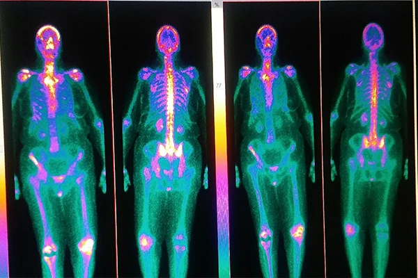 Nuclear Medicine Explained: An Overview of PET and SPECT