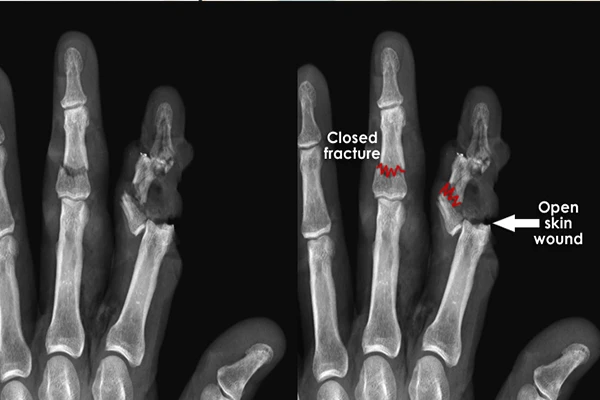 The Role of Radiology in Trauma: The Primary Survey